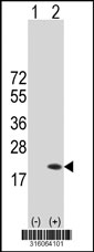 Western blot analysis of his-tag SSBP1 (arrow) using his tag antibody. 293T cell lysates (2 ug/lane) either nontransfected (Lane 1) or transiently transfected with the SSBP1 gene‘
