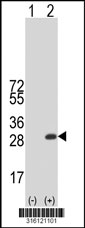 Western blot analysis of his-tag CCDC140 (arrow) using his tag antibody. 293T cell lysates (2 ug/lane) either nontransfected (Lane 1) or transiently transfected with the CCDC140 gene‘