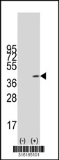 Western blot analysis of his-tag AKR1D1 (arrow) using his tag antibody. 293T cell lysates (2 ug/lane) either nontransfected (Lane 1) or transiently transfected with the AKR1D1 gene‘