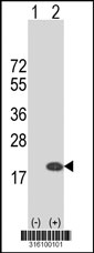 Western blot analysis of his-tag RPS20 (arrow) using his tag antibody. 293T cell lysates (2 ug/lane) either nontransfected (Lane 1) or transiently transfected with the RPS20 gene‘