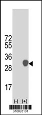 Western blot analysis of his-tag RGS17 (arrow) using his tag antibody. 293T cell lysates (2 ug/lane) either nontransfected (Lane 1) or transiently transfected with the RGS17 gene‘