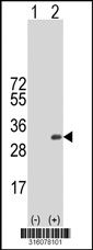Western blot analysis of his-tag C17orf59 (arrow) using his tag antibody. 293T cell lysates (2 ug/lane) either nontransfected (Lane 1) or transiently transfected with the C17orf59 gene‘