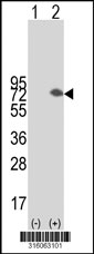 Western blot analysis of his-tag TAF1B (arrow) using his tag antibody. 293T cell lysates (2 ug/lane) either nontransfected (Lane 1) or transiently transfected with the TAF1B gene‘
