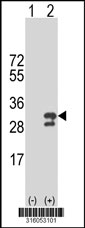 Western blot analysis of his-tag GAMT (arrow) using his tag antibody. 293T cell lysates (2 ug/lane) either nontransfected (Lane 1) or transiently transfected with the GAMT gene‘