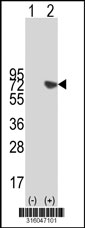 Western blot analysis of his-tag GAB1 (arrow) using his tag antibody. 293T cell lysates (2 ug/lane) either nontransfected (Lane 1) or transiently transfected with the GAB1 gene‘