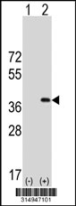 Western blot analysis of his-tag POU5F2 (arrow) using his tag antibody. 293T cell lysates (2 ug/lane) either nontransfected (Lane 1) or transiently transfected with the POU5F2 gene‘