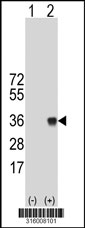 Western blot analysis of his-tag CACNA2D4 (arrow) using his tag antibody. 293T cell lysates (2 ug/lane) either nontransfected (Lane 1) or transiently transfected with the CACNA2D4 gene‘