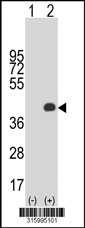 Western blot analysis of his-tag GPRC5D (arrow) using his tag antibody. 293T cell lysates (2 ug/lane) either nontransfected (Lane 1) or transiently transfected with the GPRC5D gene‘