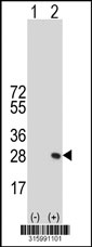 Western blot analysis of his-tag RGS8 (arrow) using his tag antibody. 293T cell lysates (2 ug/lane) either nontransfected (Lane 1) or transiently transfected with the RGS8 gene‘