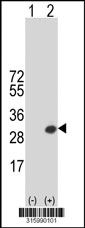 Western blot analysis of his-tag DLX6 (arrow) using his tag antibody. 293T cell lysates (2 ug/lane) either nontransfected (Lane 1) or transiently transfected with the DLX6 gene‘