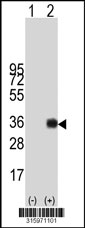 Western blot analysis of his-tag TREM1 (arrow) using his tag antibody. 293T cell lysates (2 ug/lane) either nontransfected (Lane 1) or transiently transfected with the TREM1 gene‘