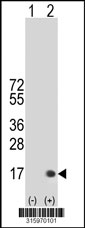 Western blot analysis of his-tag SFT2D2 (arrow) using his tag antibody. 293T cell lysates (2 ug/lane) either nontransfected (Lane 1) or transiently transfected with the SFT2D2 gene‘