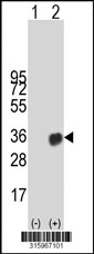 Western blot analysis of his-tag TGIF2 (arrow) using his tag antibody. 293T cell lysates (2 ug/lane) either nontransfected (Lane 1) or transiently transfected with the TGIF2 gene‘