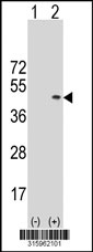 Western blot analysis of his-tag GMPR2 (arrow) using his tag antibody. 293T cell lysates (2 ug/lane) either nontransfected (Lane 1) or transiently transfected with the GMPR2 gene‘