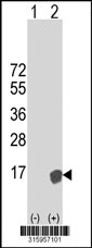 Western blot analysis of his-tag S100A12 (arrow) using his tag antibody. 293T cell lysates (2 ug/lane) either nontransfected (Lane 1) or transiently transfected with the S100A12 gene‘