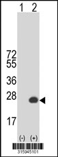 Western blot analysis of his-tag LOC554235 (arrow) using his tag antibody. 293T cell lysates (2 ug/lane) either nontransfected (Lane 1) or transiently transfected with the LOC554235 gene‘