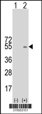 Western blot analysis of his-tag FETUB (arrow) using his tag antibody. 293T cell lysates (2 ug/lane) either nontransfected (Lane 1) or transiently transfected with the FETUB gene‘