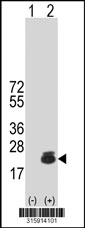 Western blot analysis of his-tag UCN3 (arrow) using his tag antibody. 293T cell lysates (2 ug/lane) either nontransfected (Lane 1) or transiently transfected with the UCN3 gene‘