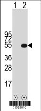 Western blot analysis of his-tag IMPACT (arrow) using his tag antibody. 293T cell lysates (2 ug/lane) either nontransfected (Lane 1) or transiently transfected with the IMPACT gene‘