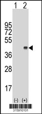 Western blot analysis of his-tag CACNG2 (arrow) using his tag antibody. 293T cell lysates (2 ug/lane) either nontransfected (Lane 1) or transiently transfected with the CACNG2 gene‘
