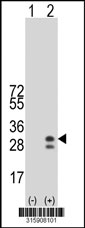 Western blot analysis of his-tag CFC1 (arrow) using his tag antibody. 293T cell lysates (2 ug/lane) either nontransfected (Lane 1) or transiently transfected with the CFC1 gene‘