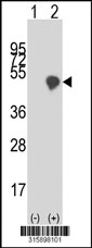 Western blot analysis of his-tag SYT5 (arrow) using his tag antibody. 293T cell lysates (2 ug/lane) either nontransfected (Lane 1) or transiently transfected with the SYT5 gene‘