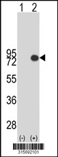 Western blot analysis of his-tag PDILT (arrow) using his tag antibody. 293T cell lysates (2 ug/lane) either nontransfected (Lane 1) or transiently transfected with the PDILT gene‘