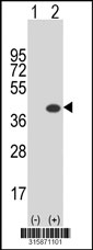 Western blot analysis of his-tag CCDC137 (arrow) using his tag antibody. 293T cell lysates (2 ug/lane) either nontransfected (Lane 1) or transiently transfected with the CCDC137 gene‘