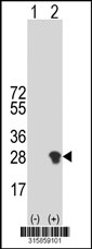 Western blot analysis of his-tag VHL (arrow) using his tag antibody. 293T cell lysates (2 ug/lane) either nontransfected (Lane 1) or transiently transfected with the VHL gene‘
