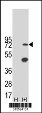 Western blot analysis of his-tag SESTD1 (arrow) using his tag antibody. 293T cell lysates (2 ug/lane) either nontransfected (Lane 1) or transiently transfected with the SESTD1 gene‘