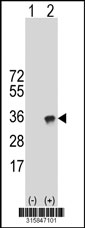 Western blot analysis of his-tag C16orf45 (arrow) using his tag antibody. 293T cell lysates (2 ug/lane) either nontransfected (Lane 1) or transiently transfected with the C16orf45 gene‘