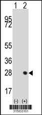 Western blot analysis of his-tag TNNI2 (arrow) using his tag antibody. 293T cell lysates (2 ug/lane) either nontransfected (Lane 1) or transiently transfected with the TNNI2 gene‘