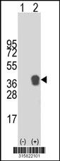 Western blot analysis of his-tag NOG (arrow) using his tag antibody. 293T cell lysates (2 ug/lane) either nontransfected (Lane 1) or transiently transfected with the NOG gene‘