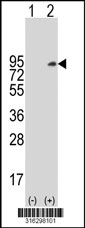 Western blot analysis of his-tag SKIL (arrow) using his tag antibody. 293T cell lysates (2 ug/lane) either nontransfected (Lane 1) or transiently transfected with the SKIL gene‘