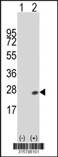 Western blot analysis of his-tag RBP5 (arrow) using his tag antibody. 293T cell lysates (2 ug/lane) either nontransfected (Lane 1) or transiently transfected with the RBP5 gene‘