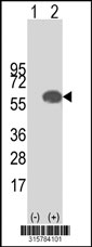Western blot analysis of his-tag TBX6 (arrow) using his tag antibody. 293T cell lysates (2 ug/lane) either nontransfected (Lane 1) or transiently transfected with the TBX6 gene‘