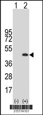 Western blot analysis of his-tag DNAJC18 (arrow) using his tag antibody. 293T cell lysates (2 ug/lane) either nontransfected (Lane 1) or transiently transfected with the DNAJC18 gene‘