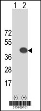 Western blot analysis of his-tag JMJD7 (arrow) using his tag antibody. 293T cell lysates (2 ug/lane) either nontransfected (Lane 1) or transiently transfected with the JMJD7 gene‘