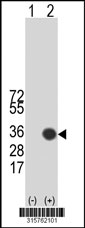 Western blot analysis of his-tag SIX2 (arrow) using his tag antibody. 293T cell lysates (2 ug/lane) either nontransfected (Lane 1) or transiently transfected with the SIX2 gene‘