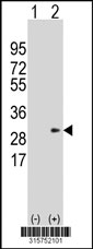 Western blot analysis of his-tag GSTA1 (arrow) using his tag antibody. 293T cell lysates (2 ug/lane) either nontransfected (Lane 1) or transiently transfected with the GSTA1 gene‘