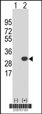 Western blot analysis of his-tag PSPH (arrow) using his tag antibody. 293T cell lysates (2 ug/lane) either nontransfected (Lane 1) or transiently transfected with the PSPH gene‘