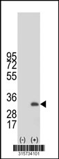 Western blot analysis of his-tag KCTD6 (arrow) using his tag antibody. 293T cell lysates (2 ug/lane) either nontransfected (Lane 1) or transiently transfected with the KCTD6 gene‘