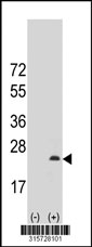 Western blot analysis of his-tag LHFP (arrow) using his tag antibody. 293T cell lysates (2 ug/lane) either nontransfected (Lane 1) or transiently transfected with the LHFP gene‘
