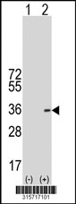 Western blot analysis of his-tag CCDC121 (arrow) using his tag antibody. 293T cell lysates (2 ug/lane) either nontransfected (Lane 1) or transiently transfected with the CCDC121 gene‘
