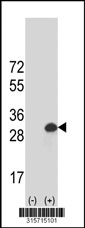 Western blot analysis of his-tag DDI2 (arrow) using his tag antibody. 293T cell lysates (2 ug/lane) either nontransfected (Lane 1) or transiently transfected with the DDI2 gene‘