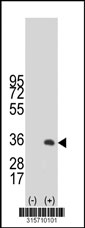 Western blot analysis of his-tag DNALI1 (arrow) using his tag antibody. 293T cell lysates (2 ug/lane) either nontransfected (Lane 1) or transiently transfected with the DNALI1 gene‘