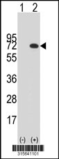 Western blot analysis of his-tag LRRC40 (arrow) using his tag antibody. 293T cell lysates (2 ug/lane) either nontransfected (Lane 1) or transiently transfected with the LRRC40 gene‘