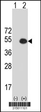 Western blot analysis of his-tag REN (arrow) using his tag antibody. 293T cell lysates (2 ug/lane) either nontransfected (Lane 1) or transiently transfected with the REN gene‘