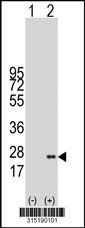 Western blot analysis of his-tag PIGH (arrow) using his tag antibody. 293T cell lysates (2 ug/lane) either nontransfected (Lane 1) or transiently transfected with the PIGH gene‘