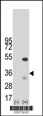Western blot analysis of his-tag MFSD1 (arrow) using his tag antibody. 293T cell lysates (2 ug/lane) either nontransfected (Lane 1) or transiently transfected with the MFSD1 gene‘